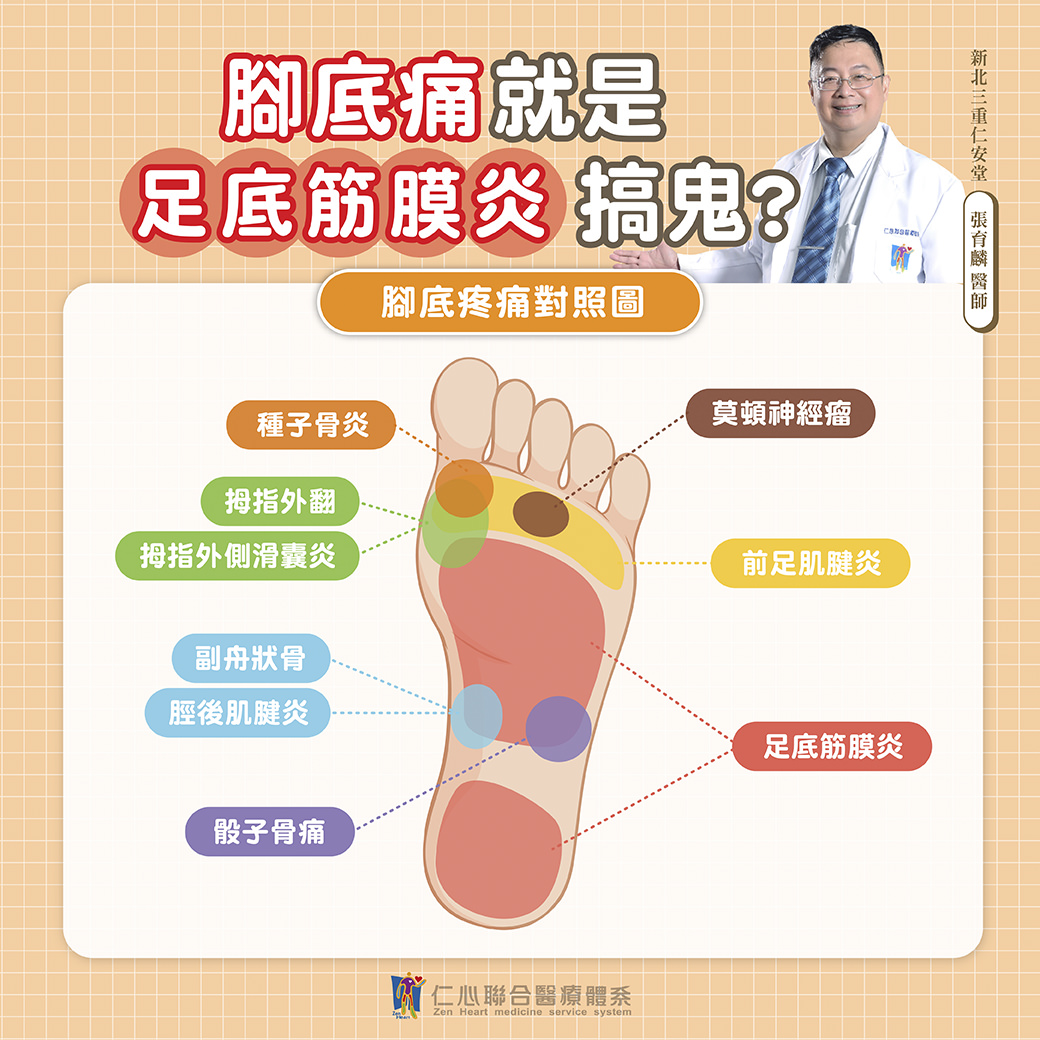腳底痛是不是足底筋膜炎的徵兆？這張圖帶您了解不同腳底痛的成因，讓您快速辨識並及早治療。從種子骨炎、腳指外翻、到副舟骨和腓骨痛，每一個疼痛點都有可能是不同問題的徵兆。特別是當出現足底筋膜炎時，常會讓您感到腳底與腳跟的劇烈不適。如果您有類似症狀，請別忽視，及時就醫診斷是關鍵！快來了解更多腳底疼痛的解決方法，讓您告別不適，重拾輕鬆行走的日常！